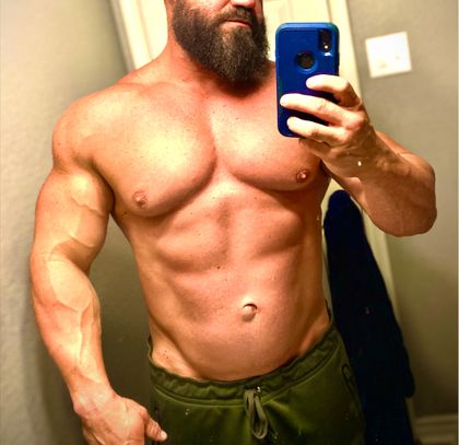 radekstrose OnlyFans picture