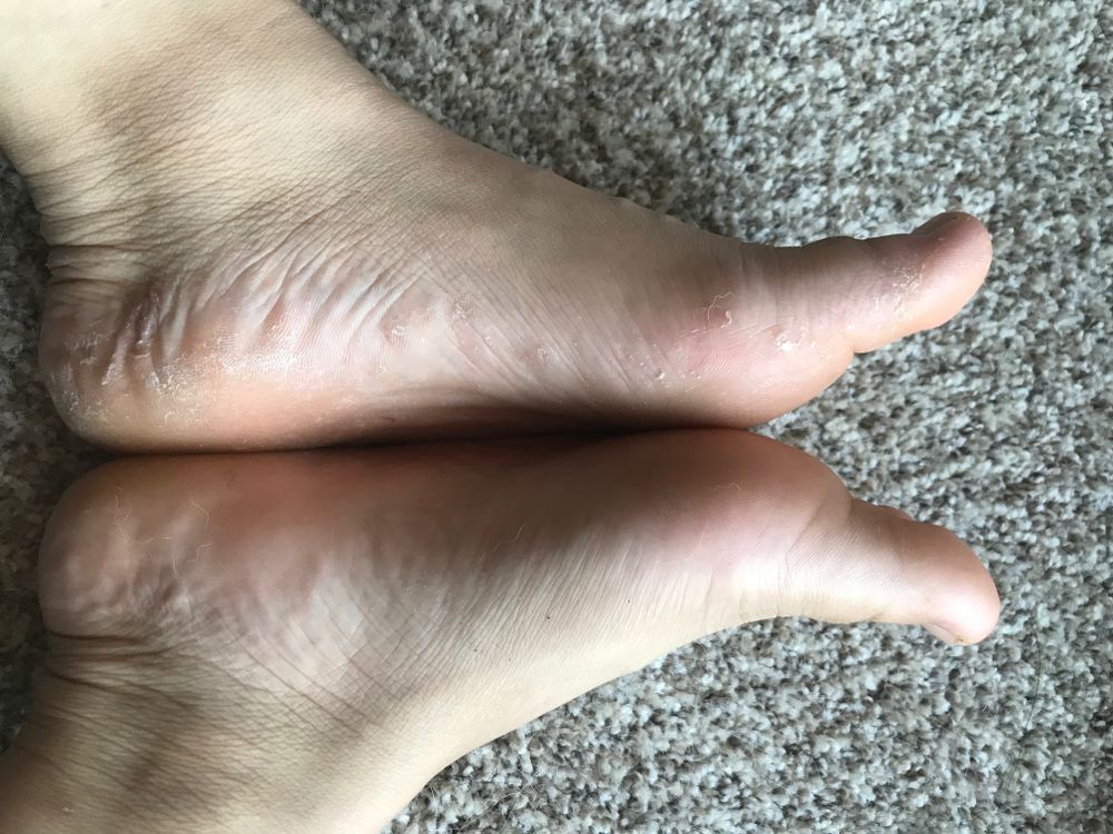 scalyfeet OnlyFans profile picture