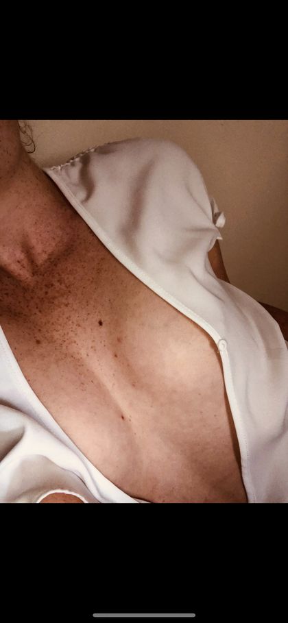 freckle_fetish OnlyFans picture