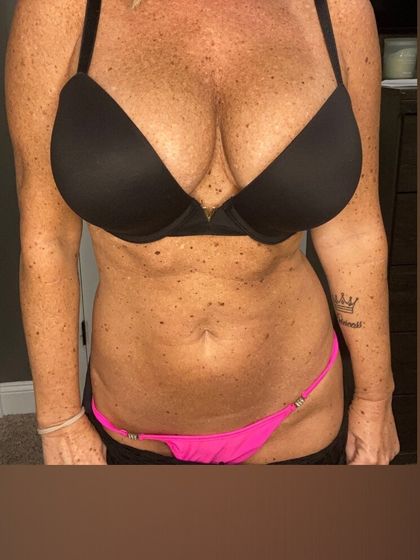 platiumdoubled OnlyFans picture