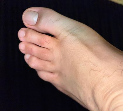 melbfeet OnlyFans picture