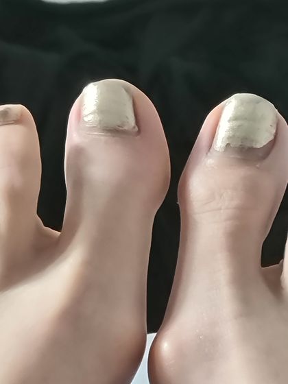 grossfeetdogrossthings OnlyFans picture