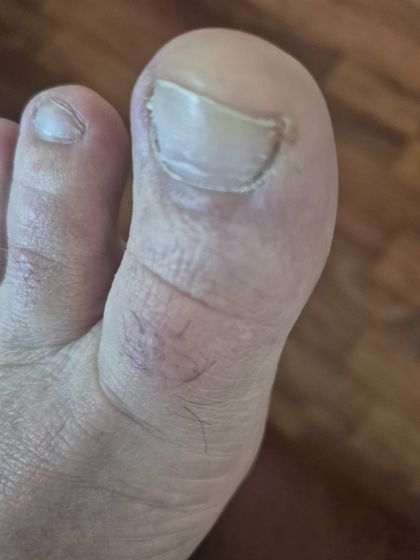 feetgirl2025 OnlyFans picture