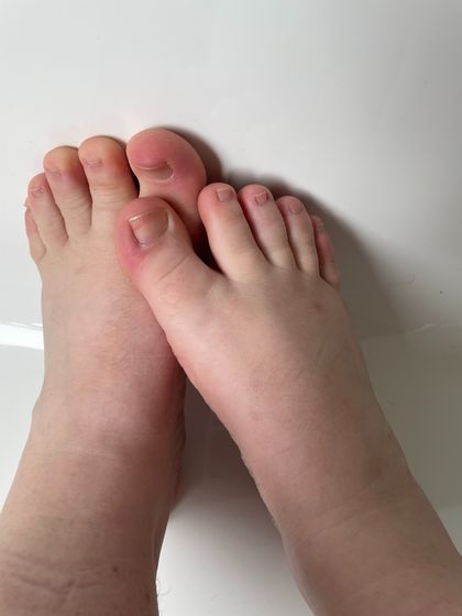 ausonlyfeet OnlyFans picture