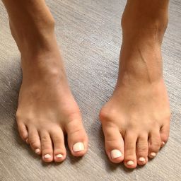paulbunionfeetlove OnlyFans picture
