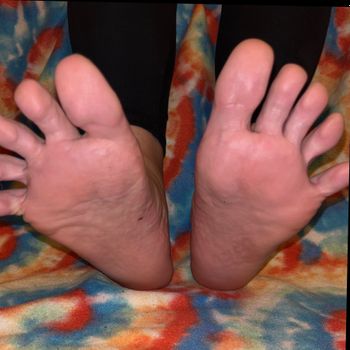 Those & These Feet