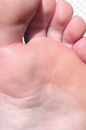 stinkywinky007 OnlyFans picture