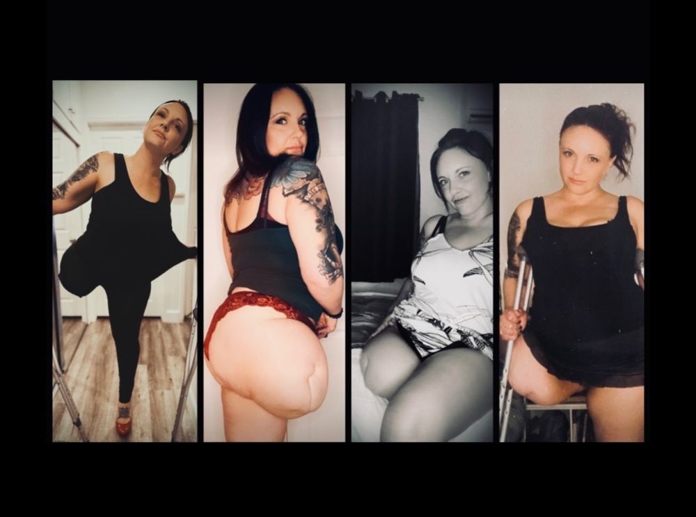 amputeedarling OnlyFans profile picture