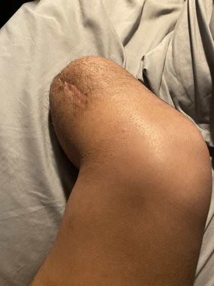 strongamputee OnlyFans picture