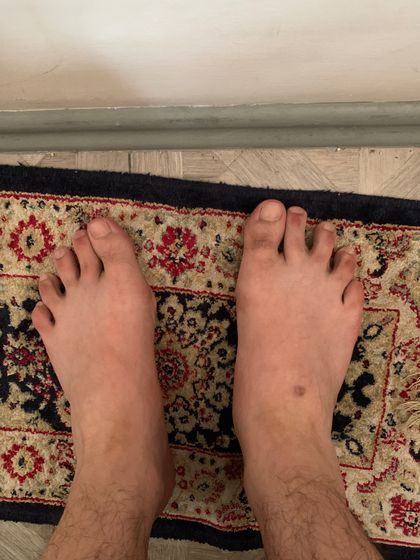 my_ugly_feet OnlyFans picture