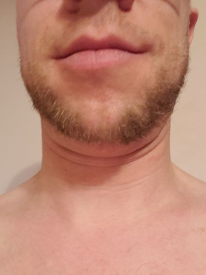 baldjackbear OnlyFans picture