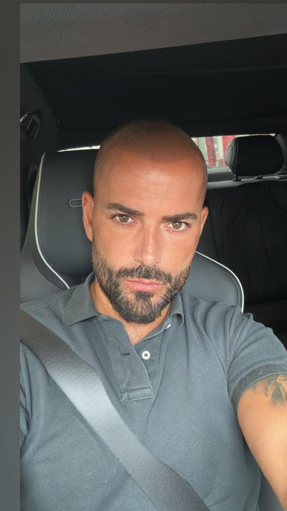 iambaldguy OnlyFans picture