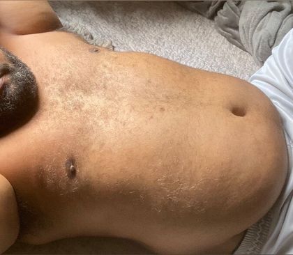 allerin OnlyFans picture