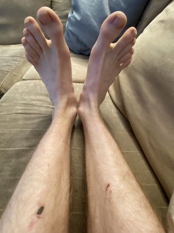 FeetWithScares