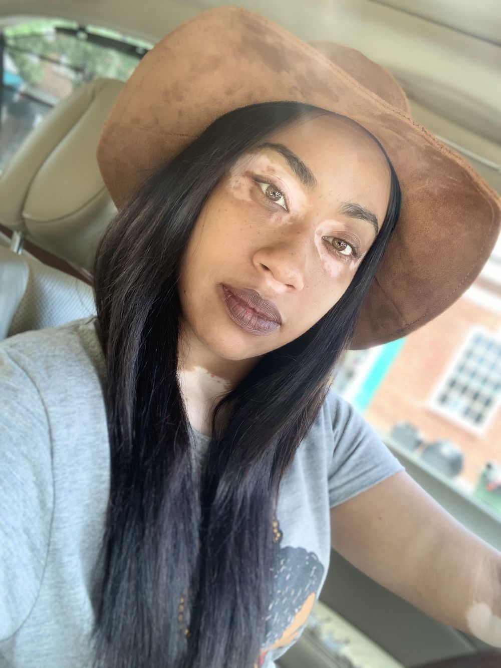 vitiligofox OnlyFans profile picture