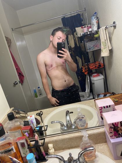 transcidal OnlyFans picture