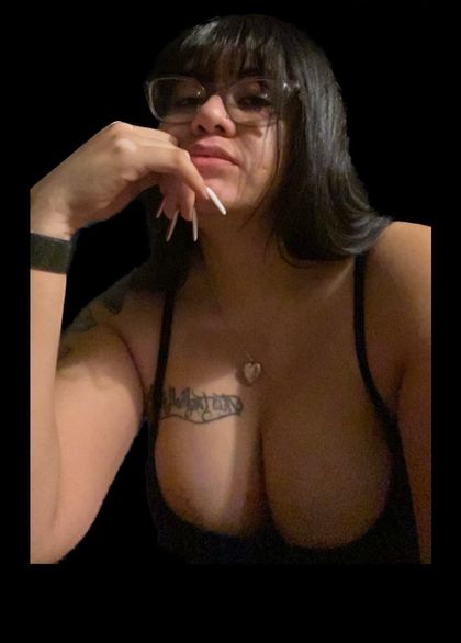 vitiligobabbyyy OnlyFans picture
