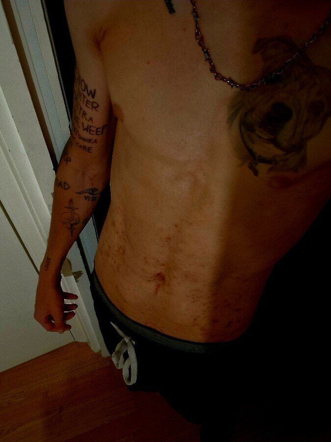 ryandiabetesoffical OnlyFans profile picture