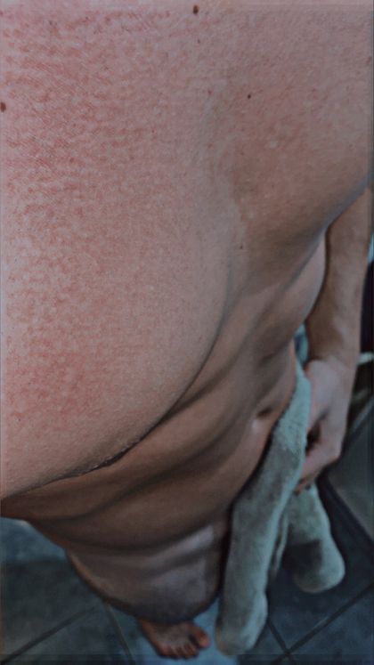 rotwinnie OnlyFans picture