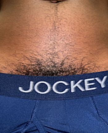Trans Merkin