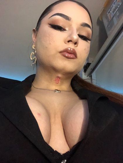 isau-positive OnlyFans picture