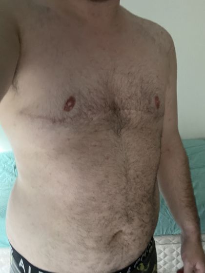 ftmbondage OnlyFans picture