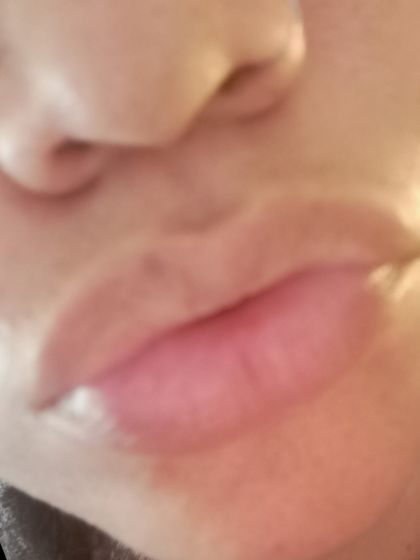 lipsandall OnlyFans picture
