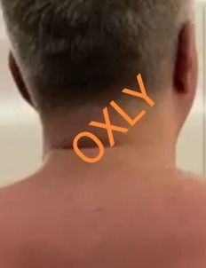 oxlyoxly OnlyFans picture