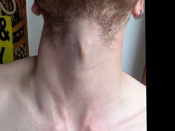 Adam's Apple