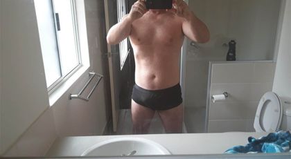 hairtransplantme OnlyFans picture