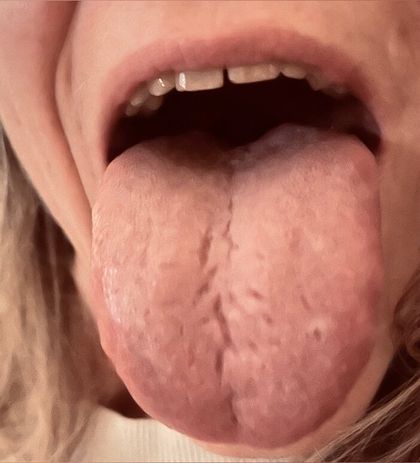 poppyslongtongue OnlyFans picture