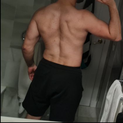 scolioromeo OnlyFans picture
