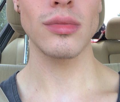 jcublake OnlyFans picture