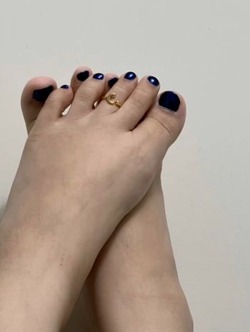 Toe wonder or not toe wonder