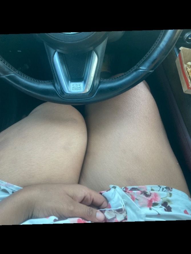 amputeehottie OnlyFans profile picture