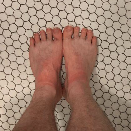 feetchicago OnlyFans picture