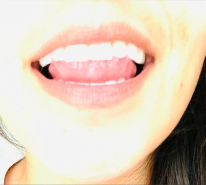 sunshine-kissed OnlyFans picture