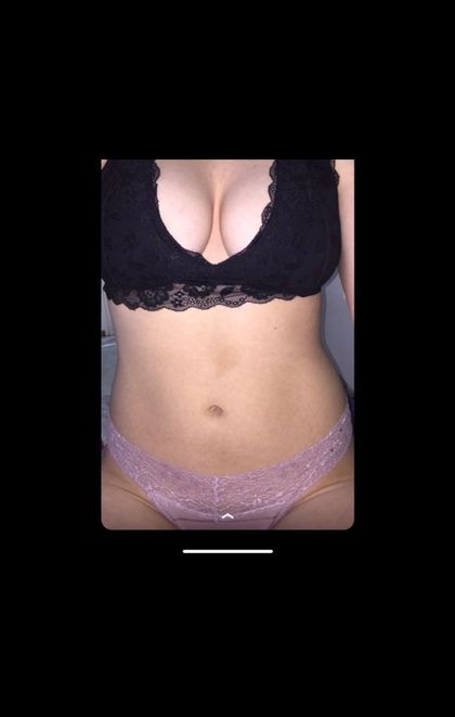 xoxoblitz OnlyFans picture