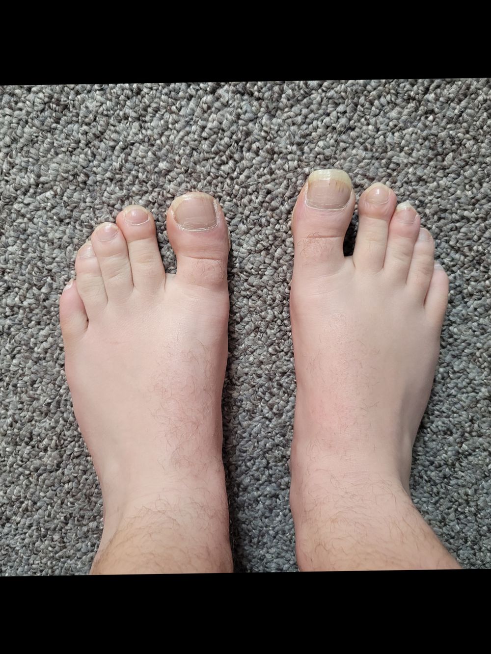 bigbigtoes OnlyFans profile picture