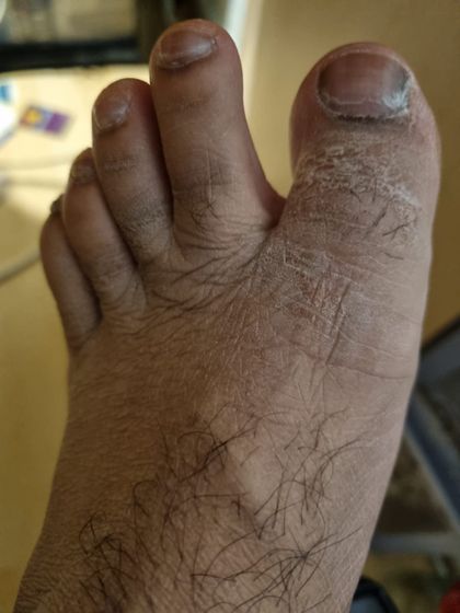 mruglyfeetalpa OnlyFans picture