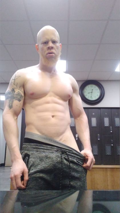 albinolust OnlyFans picture