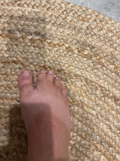 nonsexyfeet OnlyFans picture