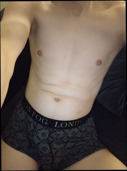 xmicedx OnlyFans picture