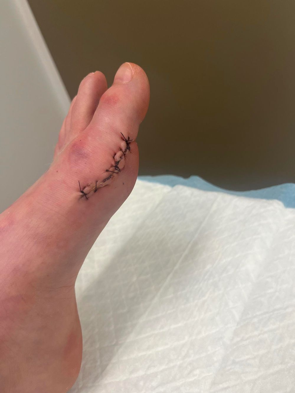 injuredfootqueen OnlyFans profile picture
