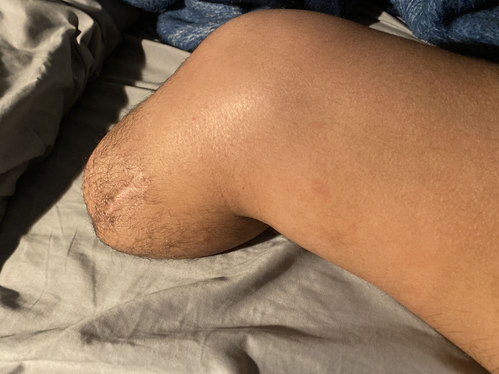 strongamputee OnlyFans profile picture