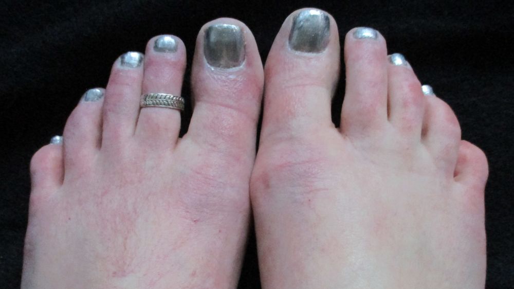 redlighteningfoot OnlyFans profile picture