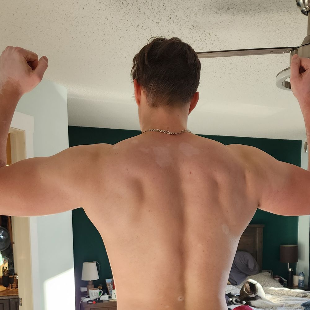 vitiligoboy97 OnlyFans profile picture