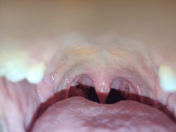 Endoscopymount