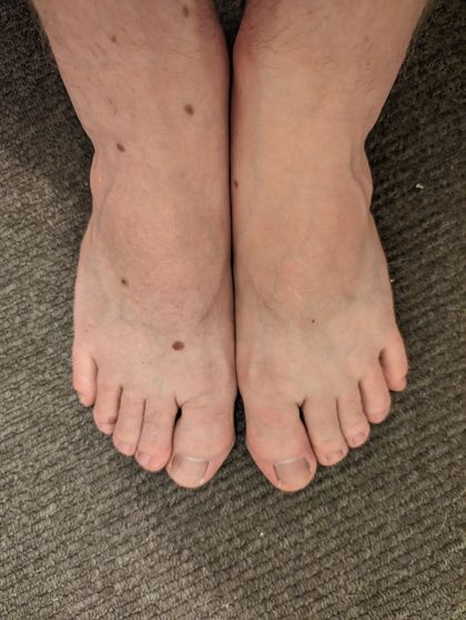 hairyhobbittoes OnlyFans picture