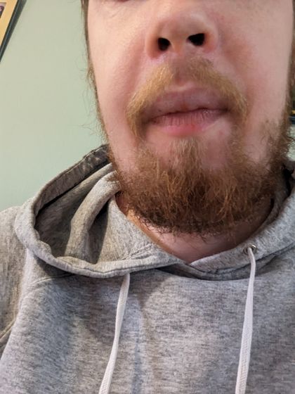 thelimeman OnlyFans picture